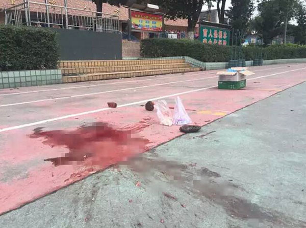 广州一年级小学生在学校操场被校车撞死